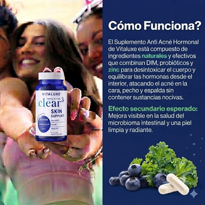 Suplemento Anti-Acné Hormonal Vitaluxe